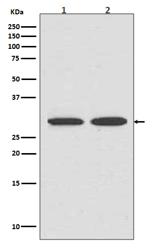 Rabbit Monoclonal to VDAC1
