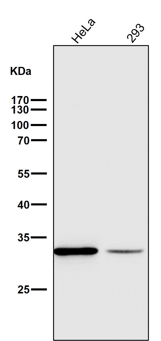 Rabbit Monoclonal to VDAC1