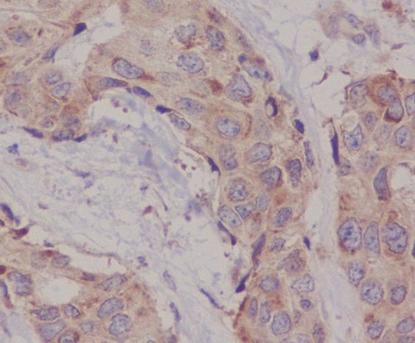 Rabbit Monoclonal to Hsc70