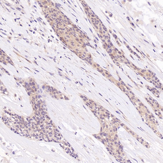 Rabbit Monoclonal to Hsc70