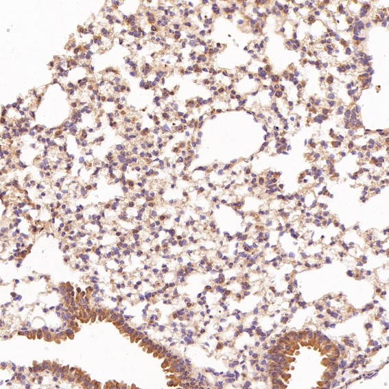 Rabbit Monoclonal to Hsc70