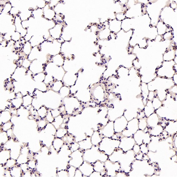 Rabbit Monoclonal to Hsc70