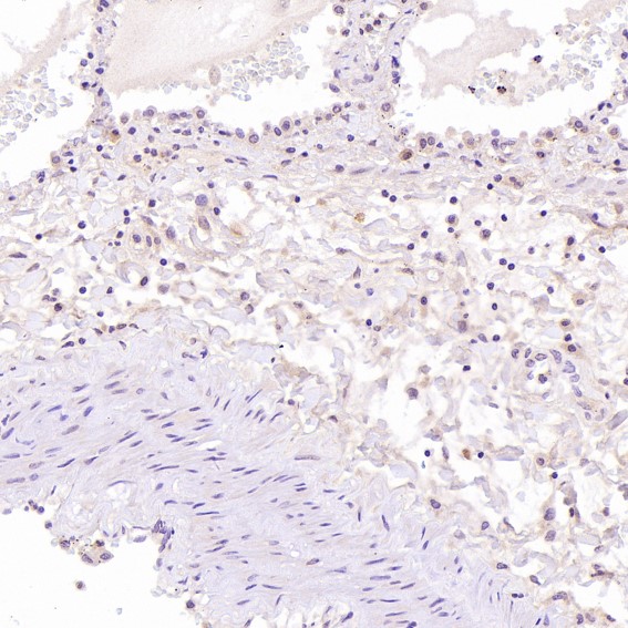 Rabbit Monoclonal to Hsc70