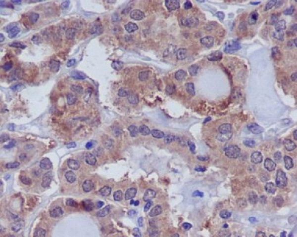 Rabbit Monoclonal to DUSP6