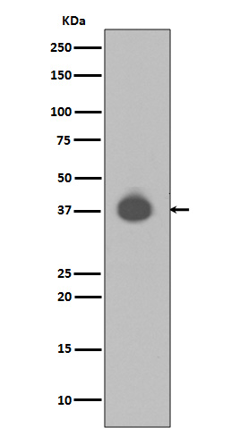 DUSP6