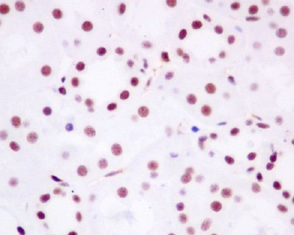 Rabbit Monoclonal to Brd4