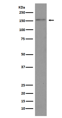 Rabbit Monoclonal to Brd4