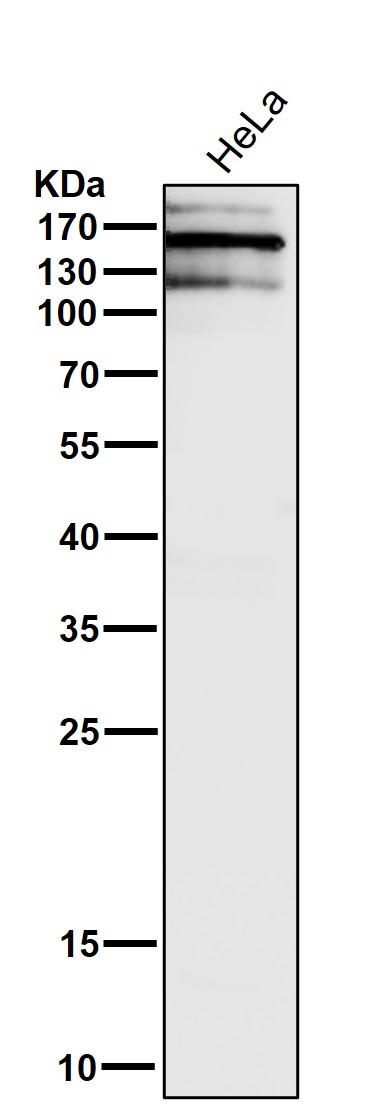 Rabbit Monoclonal to Brd4