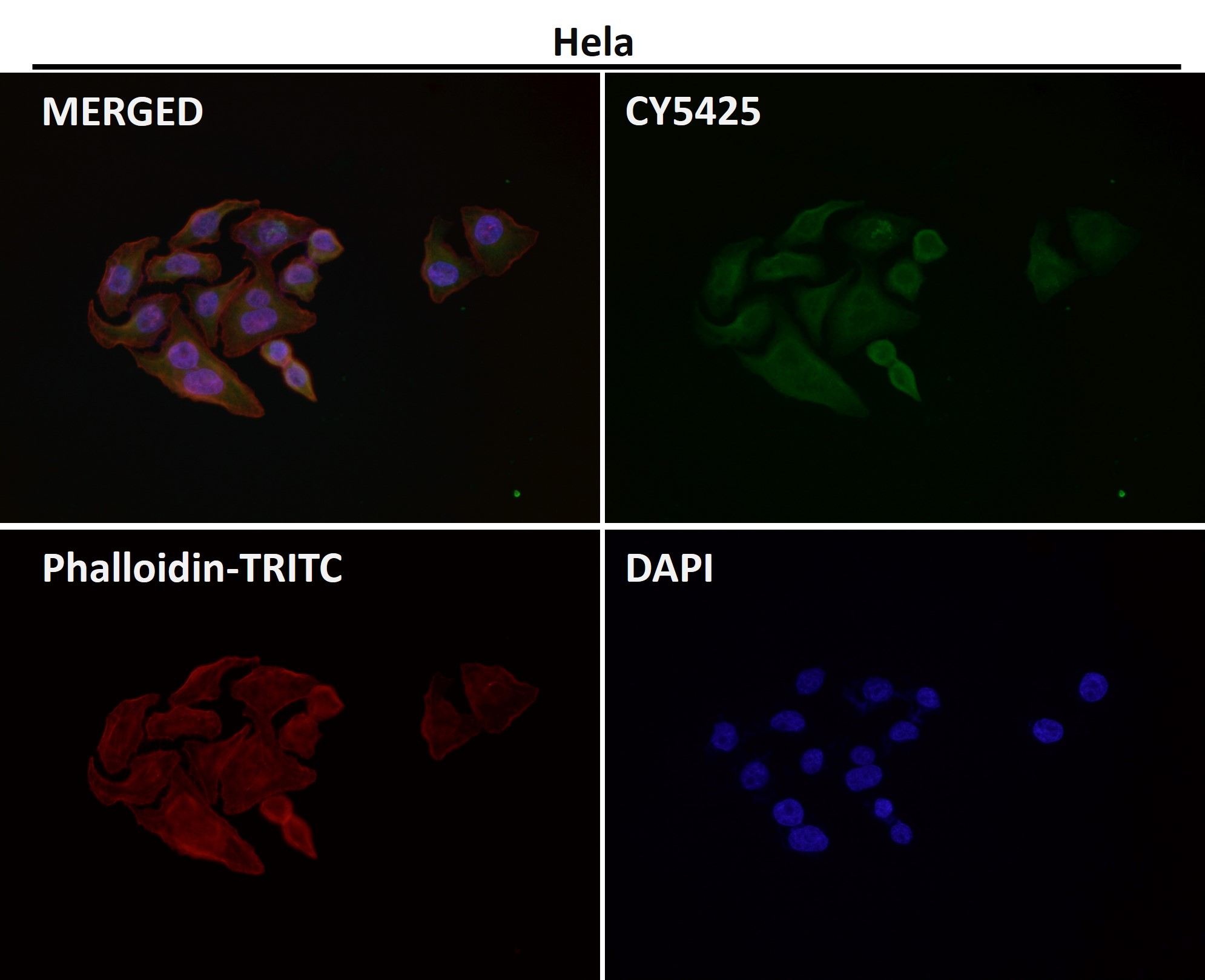 Rabbit Monoclonal to AKT1/2/3