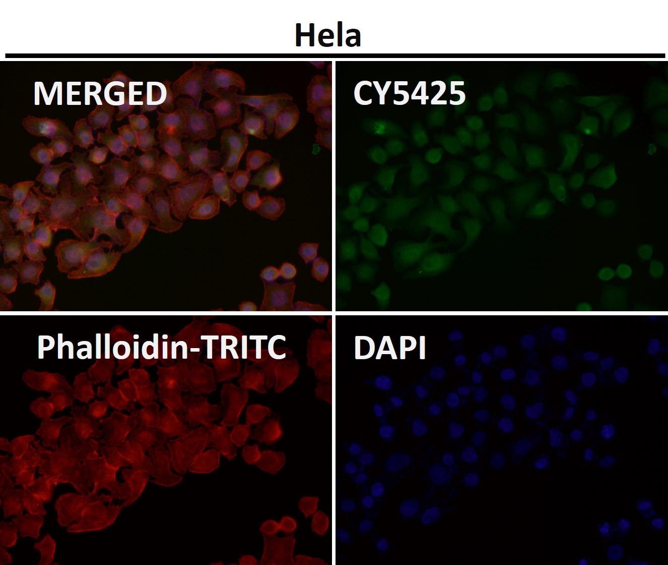 Rabbit Monoclonal to AKT1/2/3