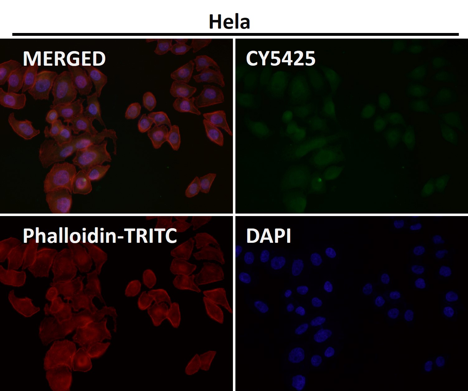 Rabbit Monoclonal to AKT1/2/3