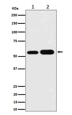Rabbit Monoclonal to AKT1/2/3