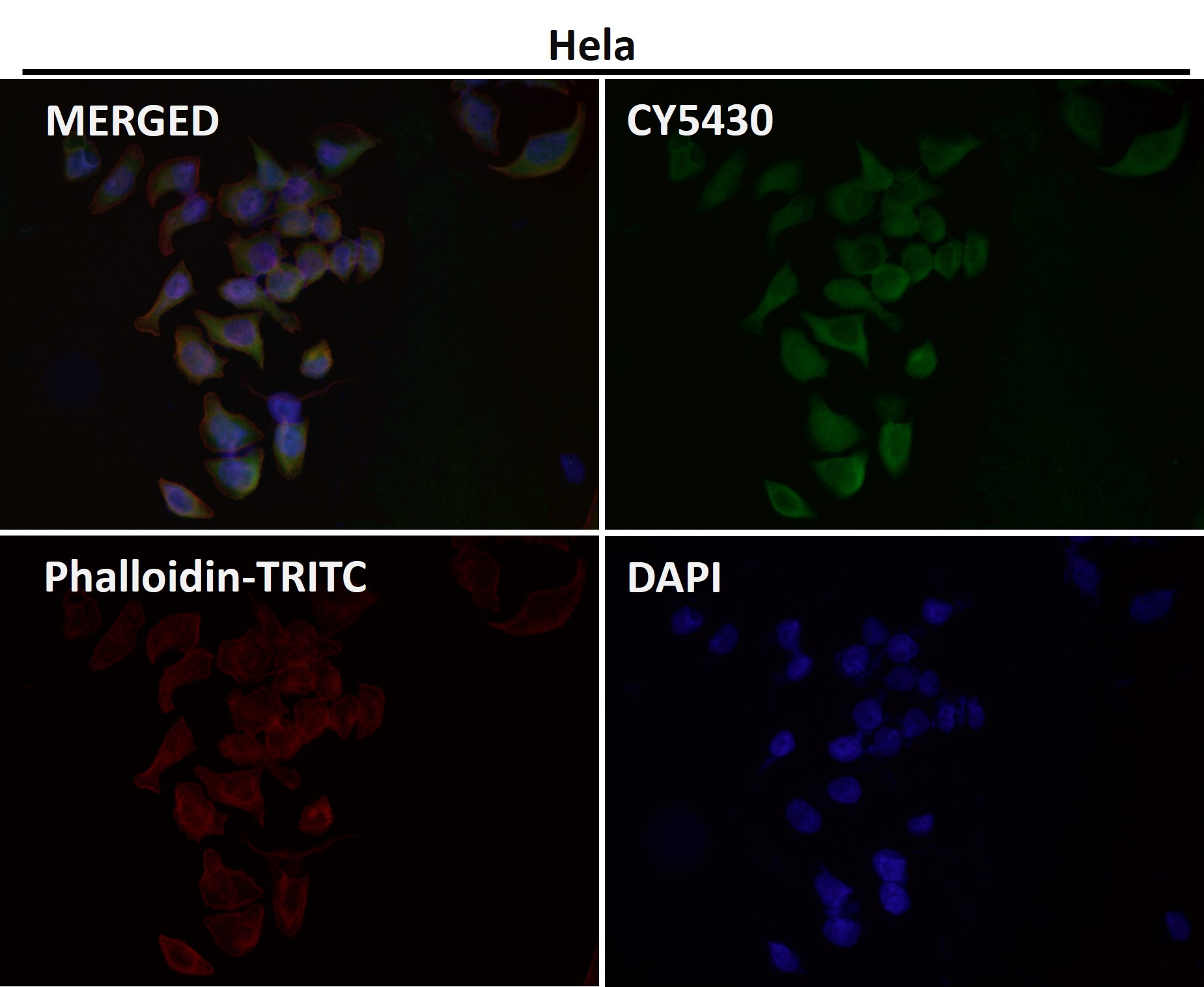 Rabbit Monoclonal to HN1