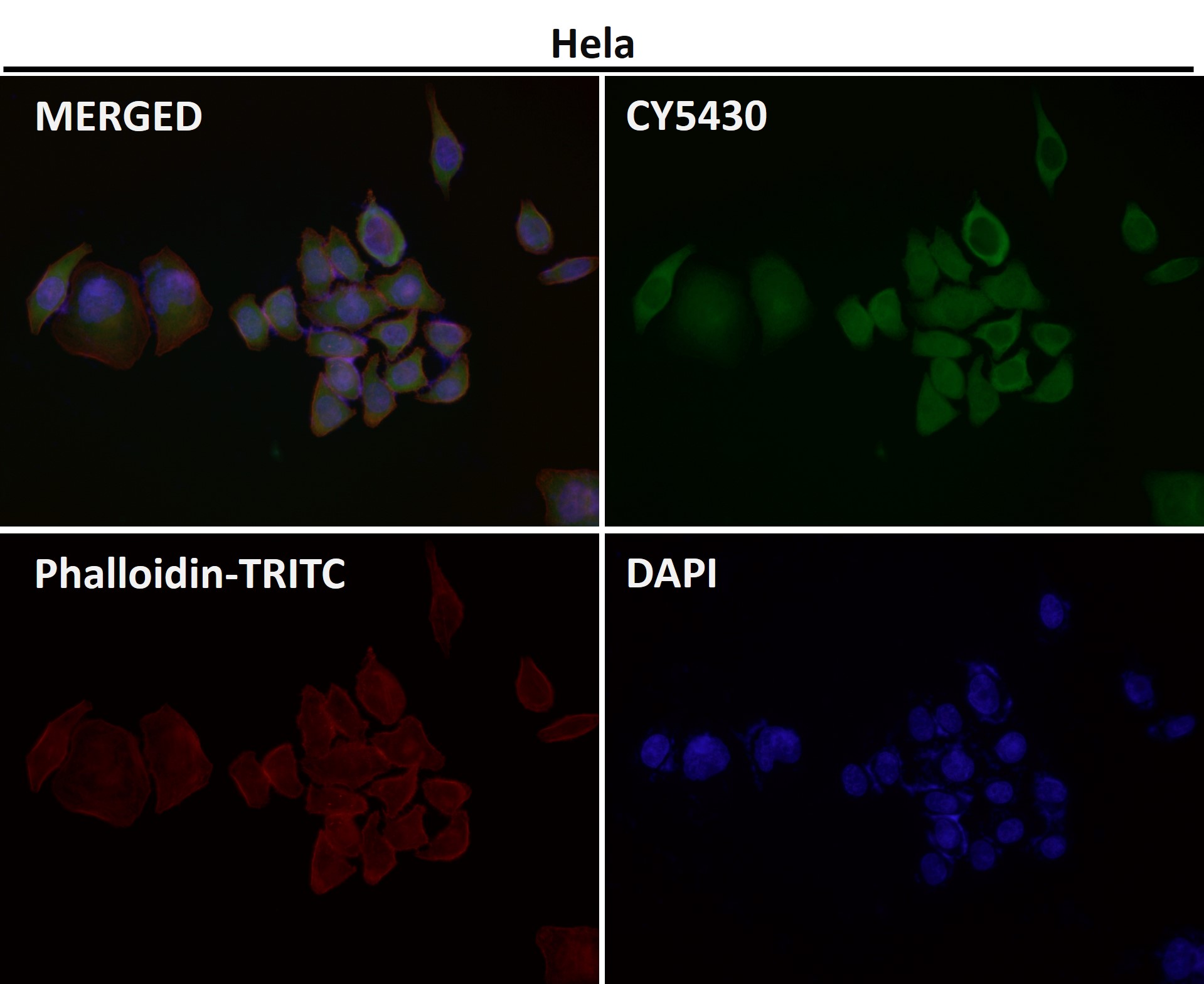 Rabbit Monoclonal to HN1