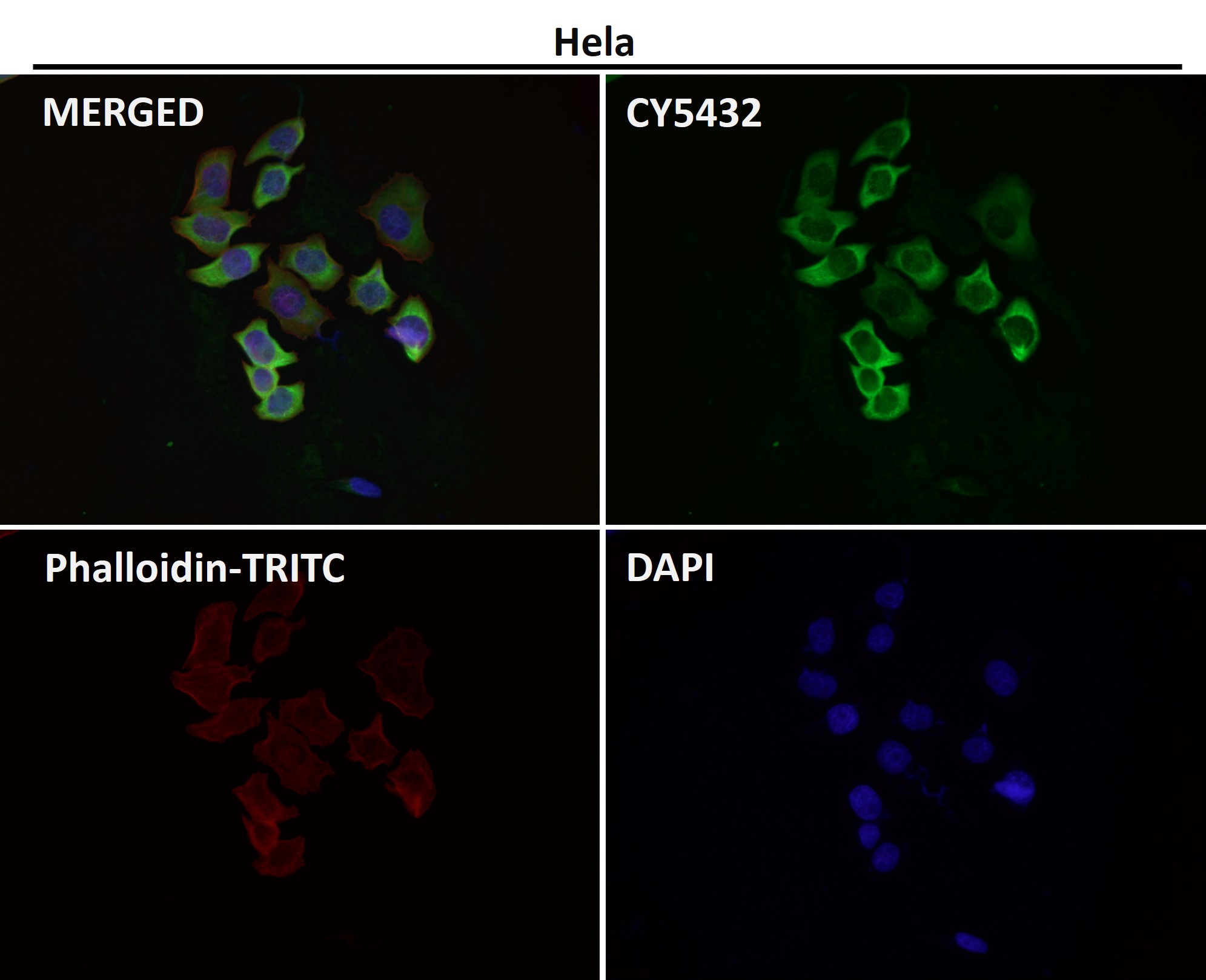 Rabbit Monoclonal to eIF3A