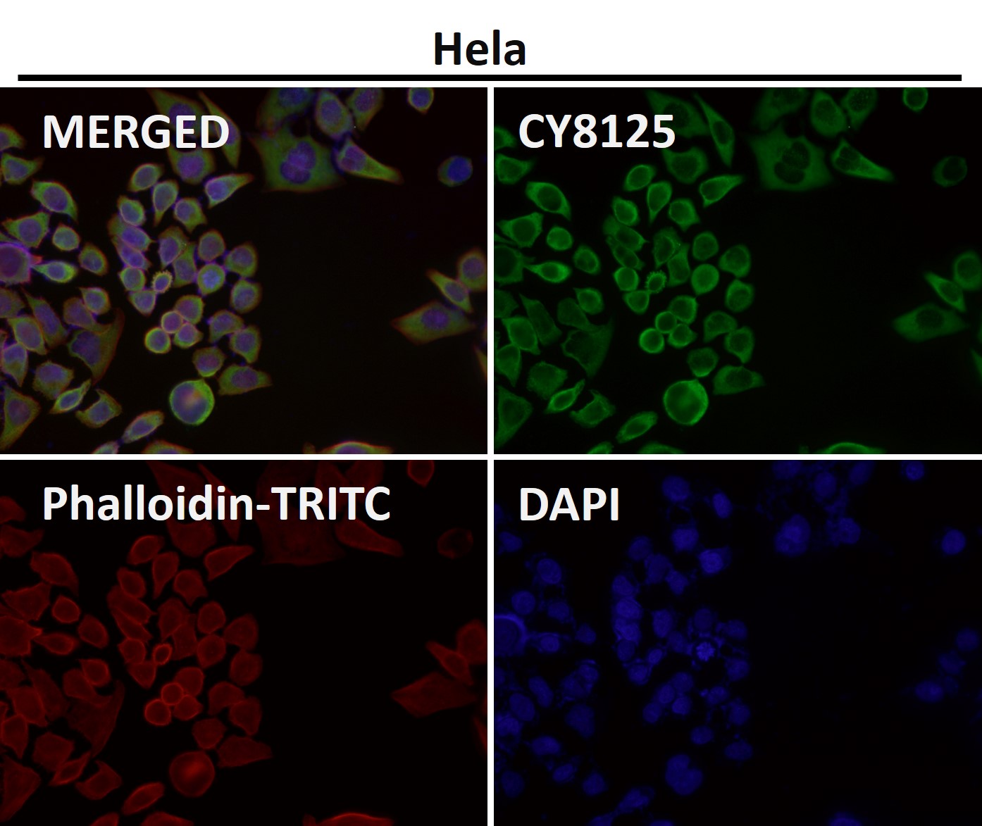 Rabbit Monoclonal to eIF3A