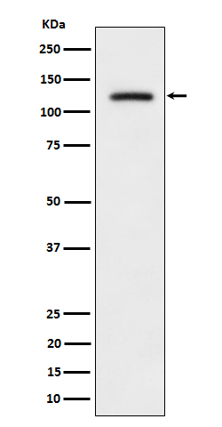 Rabbit Monoclonal to Phospho-ULK1(S556)