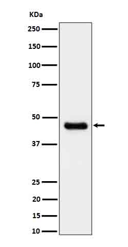 Rabbit Monoclonal to CABP