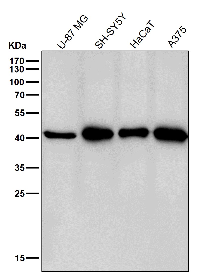Rabbit Monoclonal to CABP