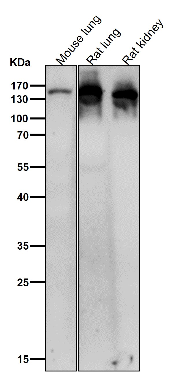 Ceruloplasmin