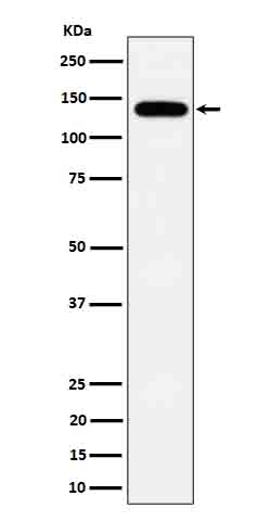 Tripeptidyl peptidase 2