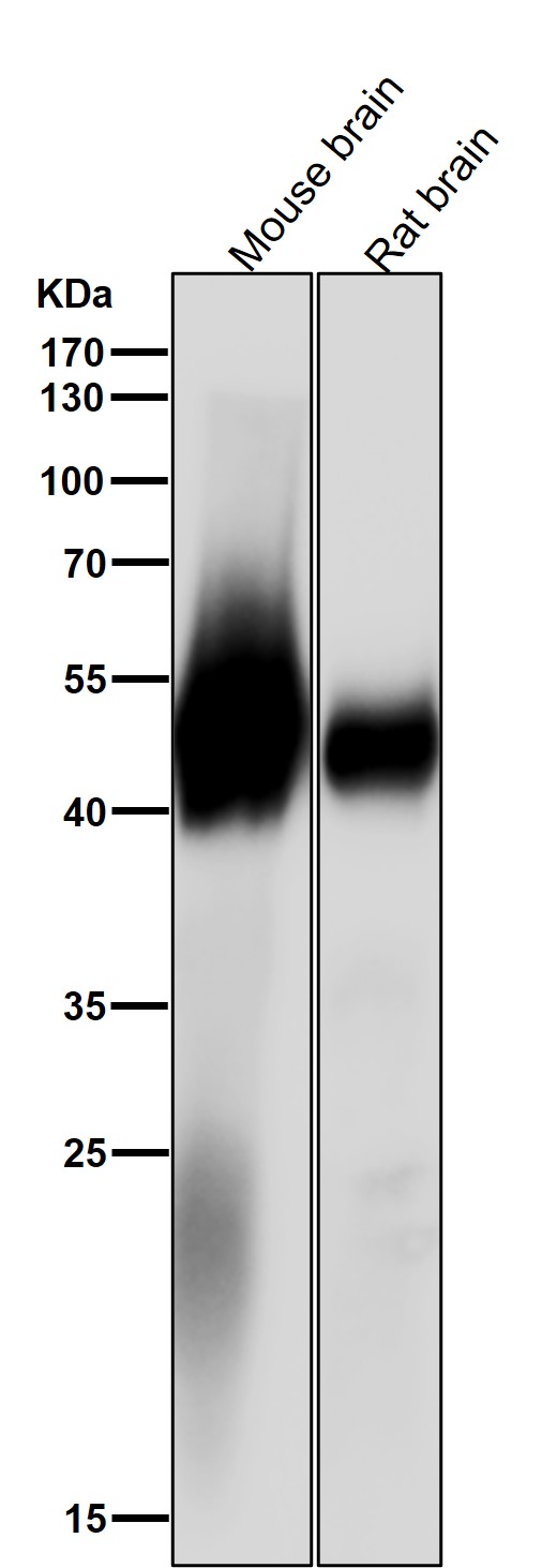 alpha Tubulin(acetylK40)