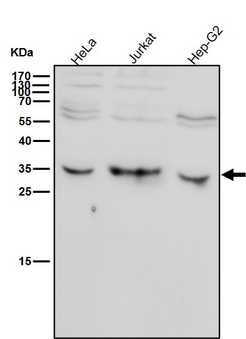 Phospho-HistoneH1.4(T17)