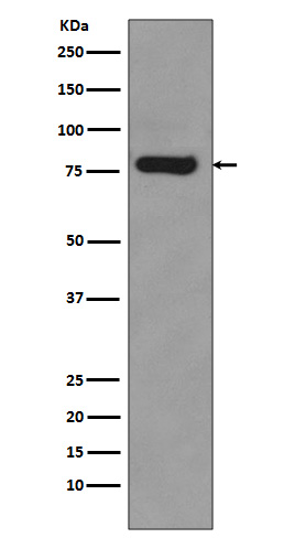 Androgen Receptor