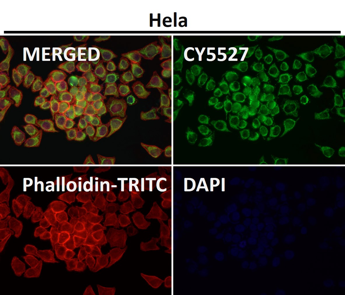 Rabbit Monoclonal to TOMM20