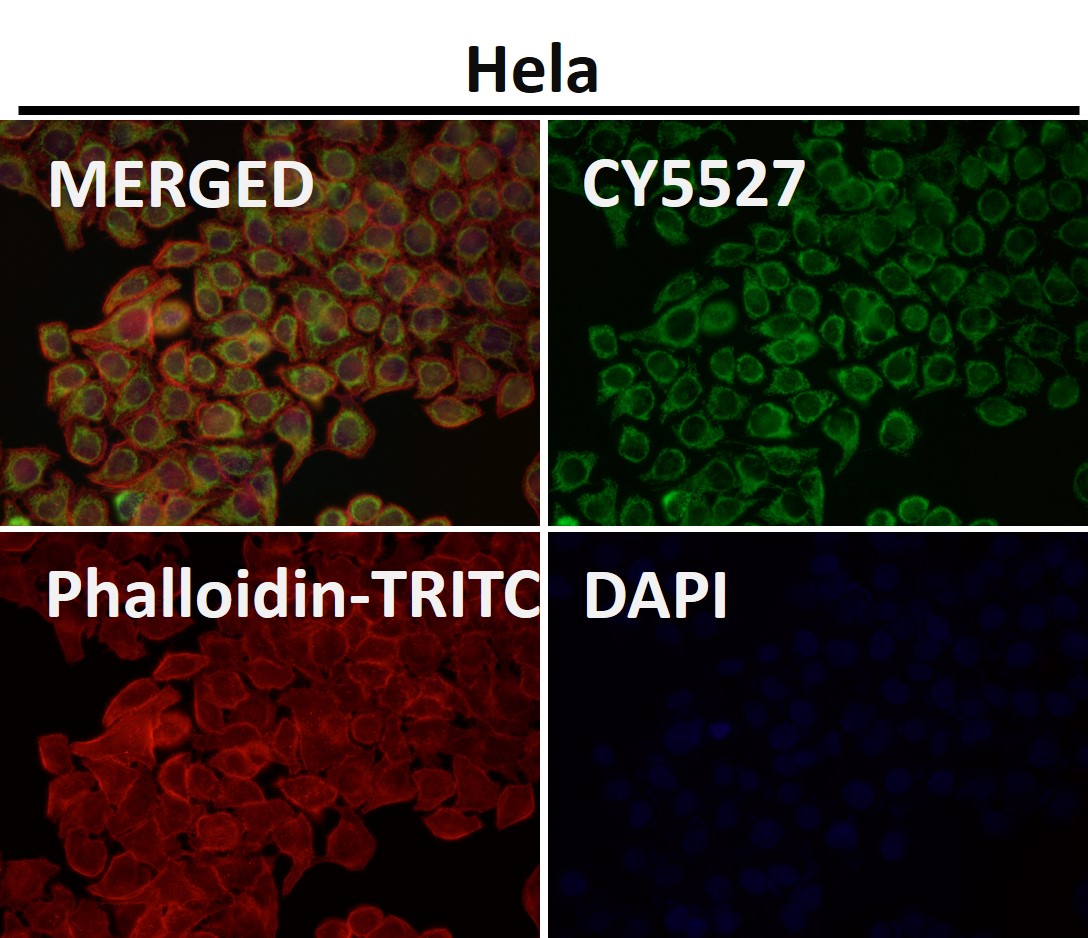 Rabbit Monoclonal to TOMM20