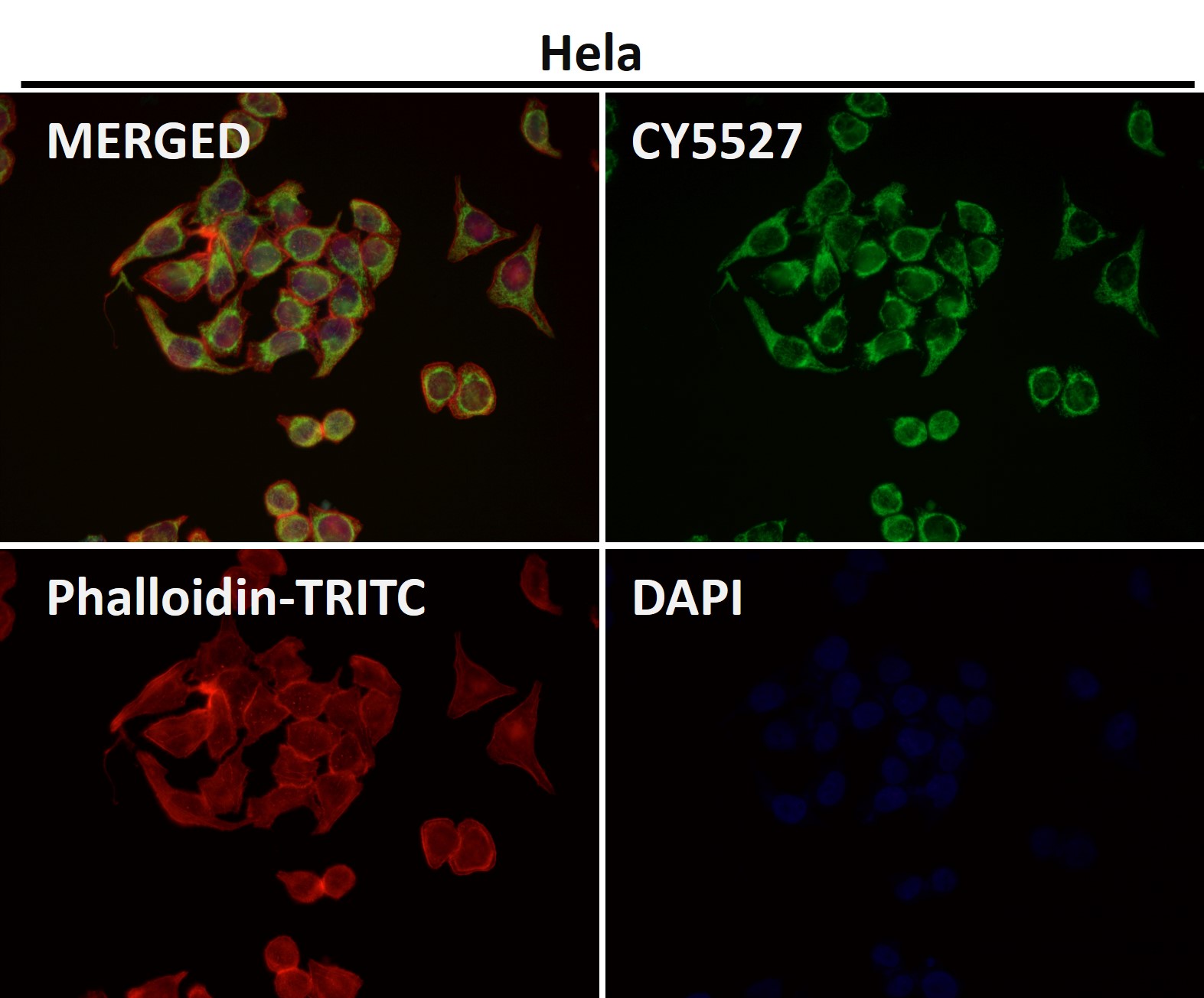 Rabbit Monoclonal to TOMM20