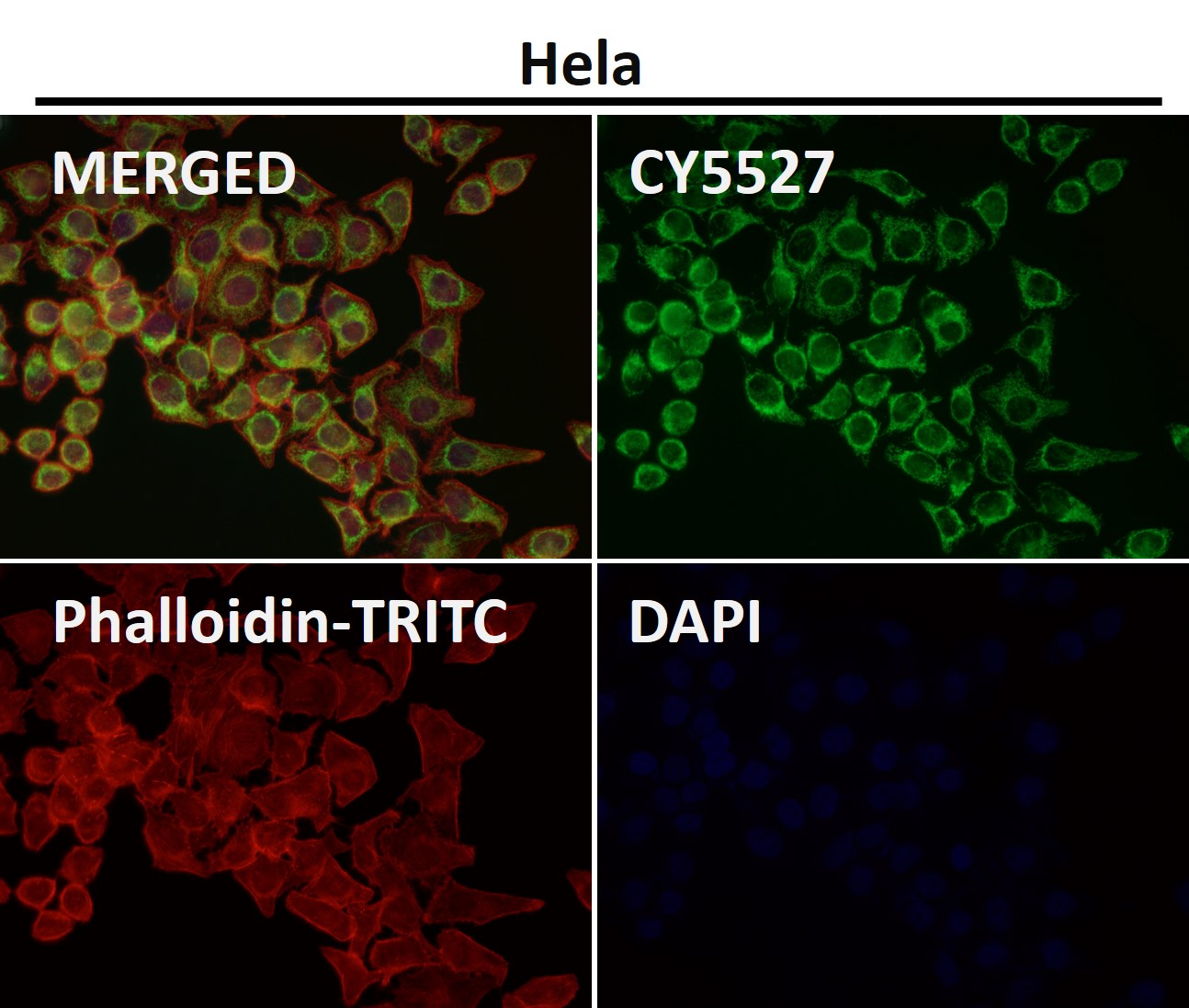 Rabbit Monoclonal to TOMM20