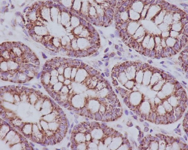 Rabbit Monoclonal to TOMM20
