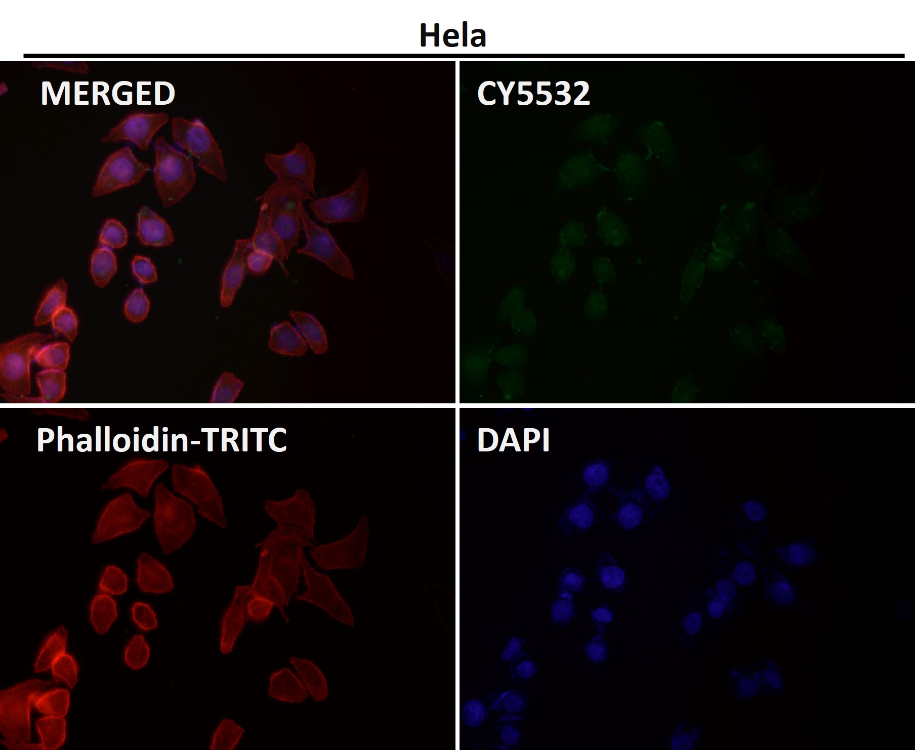 Rabbit Monoclonal to PI3 Kinase p85 beta