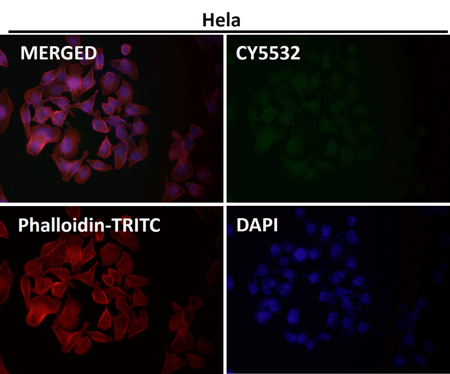 Rabbit Monoclonal to PI3 Kinase p85 beta