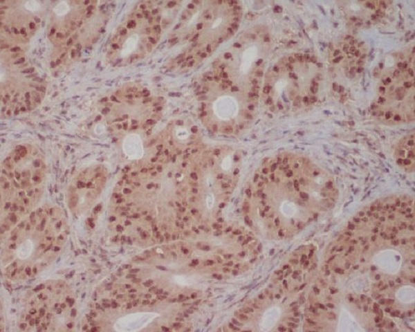 Rabbit Monoclonal to PI3 Kinase p85 beta