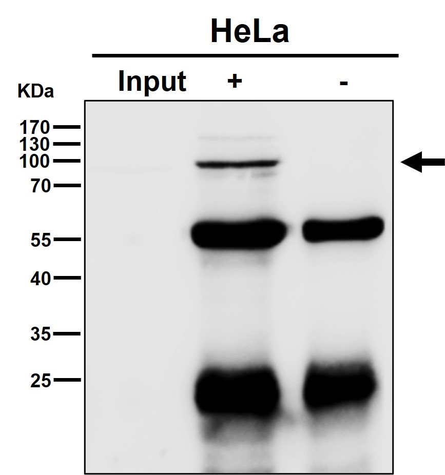 Rabbit Monoclonal to PI3 Kinase p85 beta