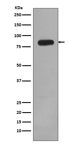 Rabbit Monoclonal to PI3 Kinase p85 beta