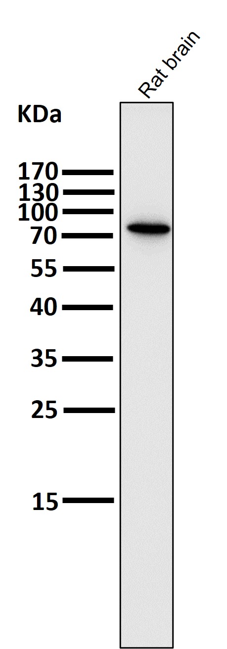 PI3 Kinase p85 beta