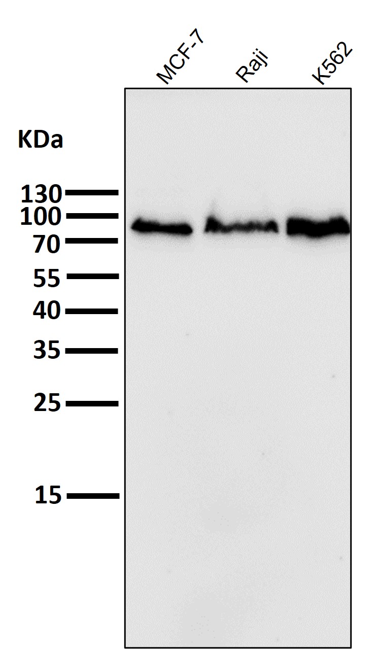 Rabbit Monoclonal to PI3 Kinase p85 beta