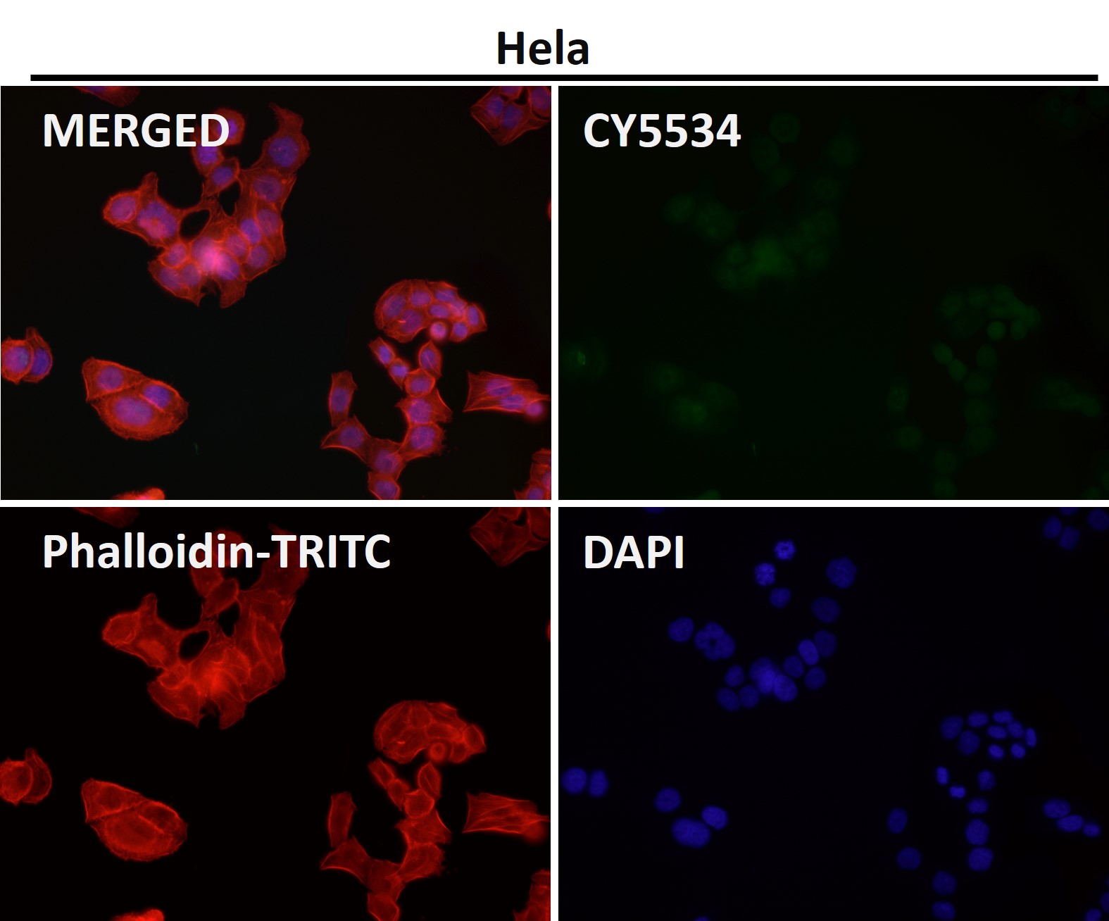 Rabbit Monoclonal to DGCR8