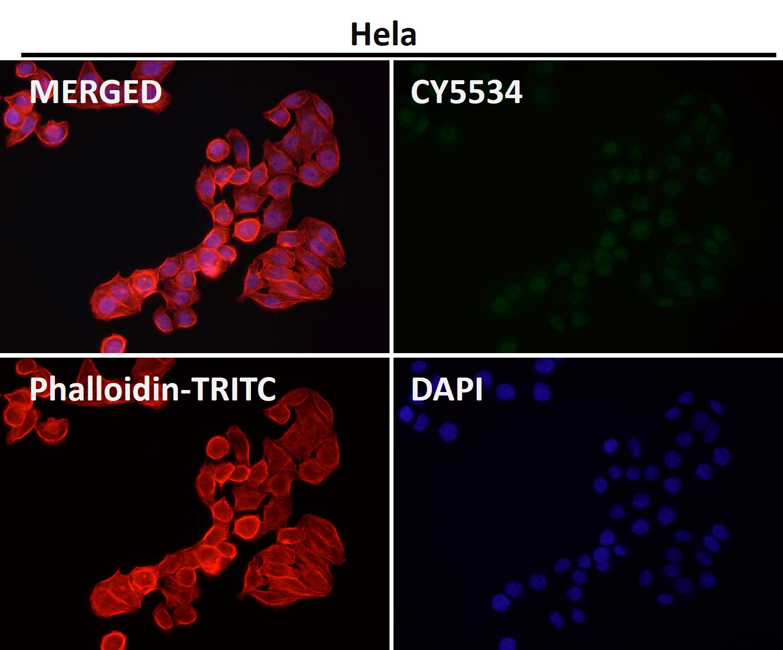 Rabbit Monoclonal to DGCR8