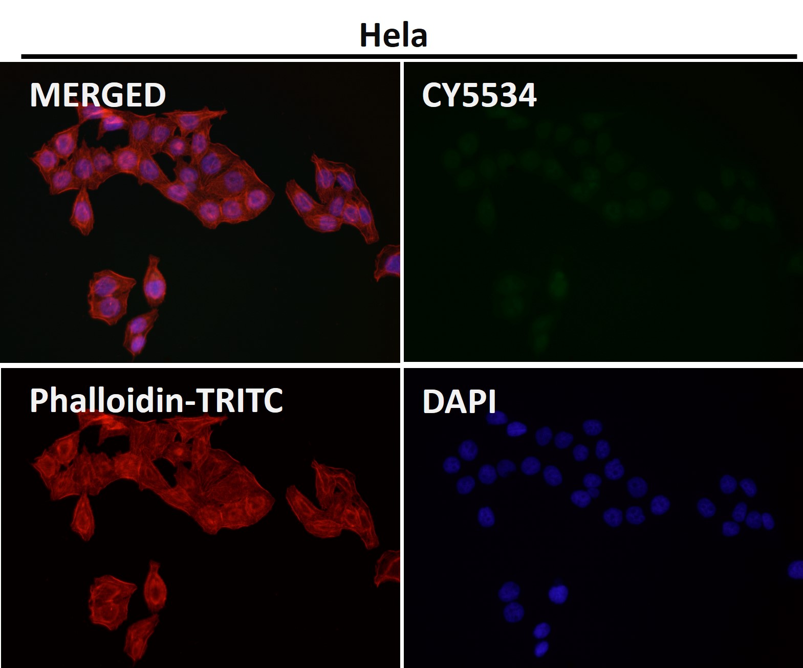 Rabbit Monoclonal to DGCR8
