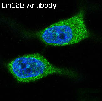 Rabbit Monoclonal to Lin 28B