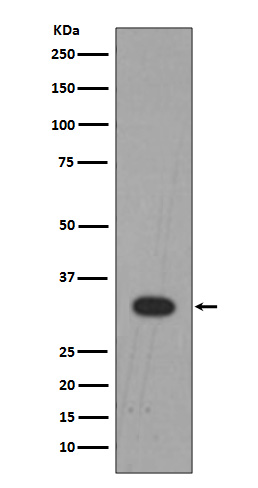 Rabbit Monoclonal to Lin 28B