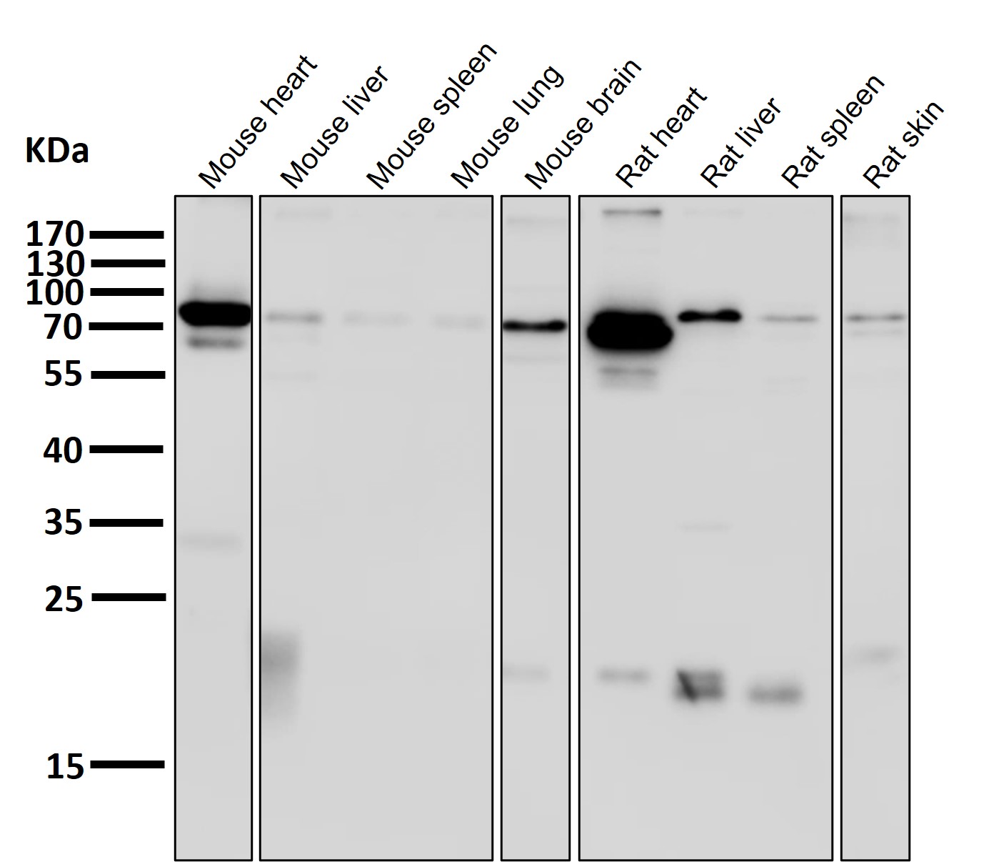 HIF-1beta