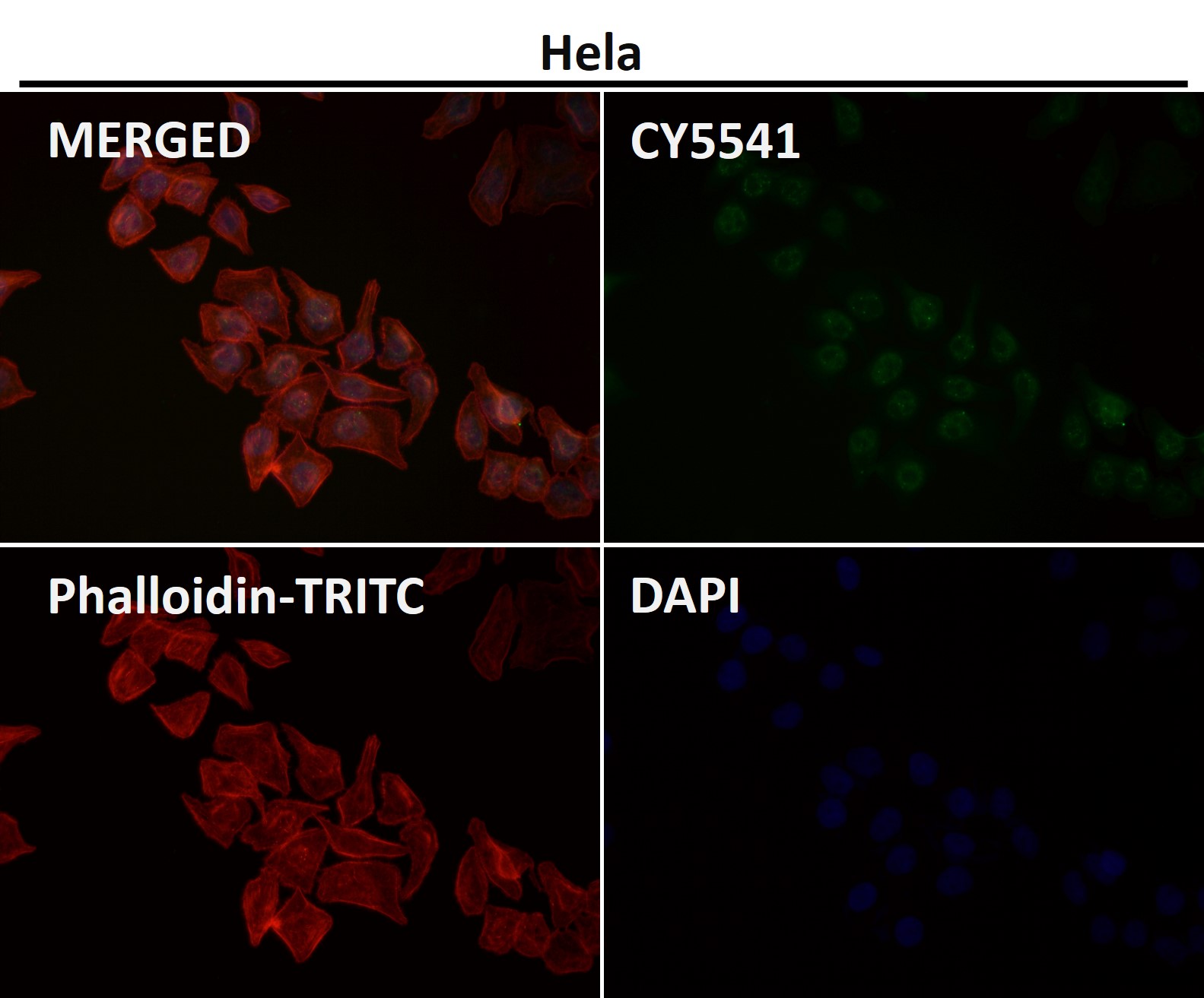 Rabbit Monoclonal to Phospho-JNK1/2/3(T183+T183+T221)