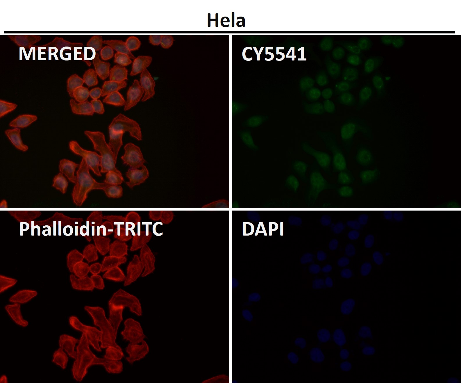 Rabbit Monoclonal to Phospho-JNK1/2/3(T183+T183+T221)