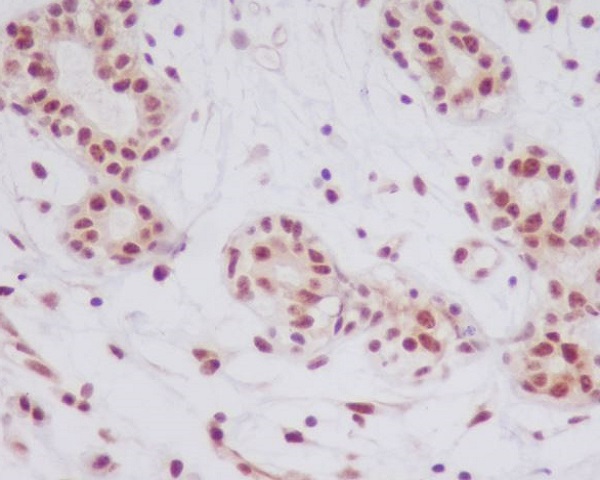 Rabbit Monoclonal to Phospho-JNK1/2/3(T183+T183+T221)
