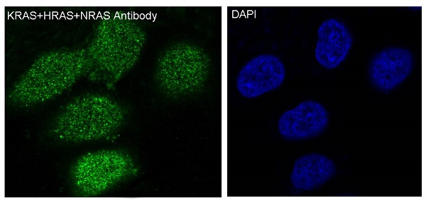 Rabbit Monoclonal to KRAS+HRAS+NRAS